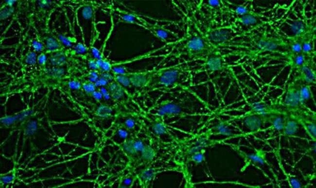 100UL GAP43 ANTIBODY 100 ul