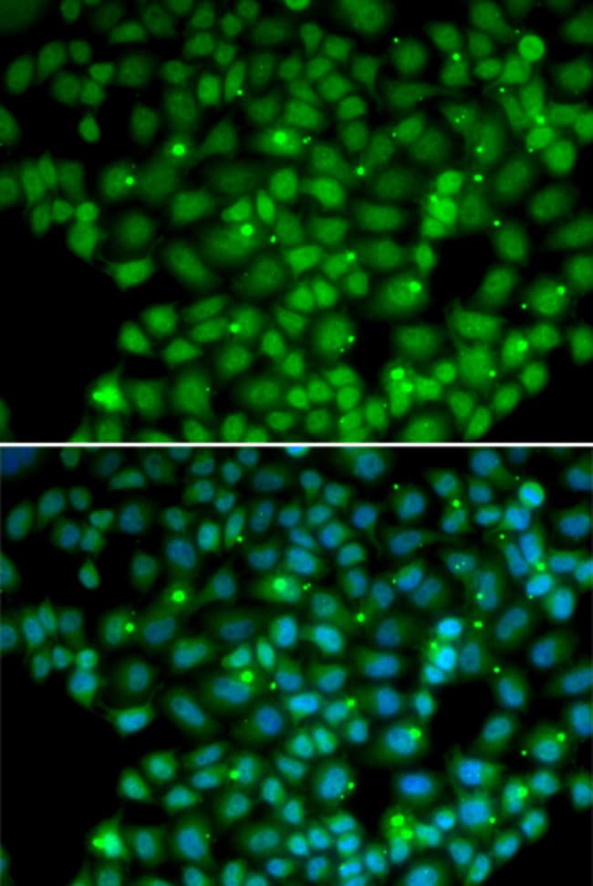 100UL MUTYH ANTIBODY 100 ul