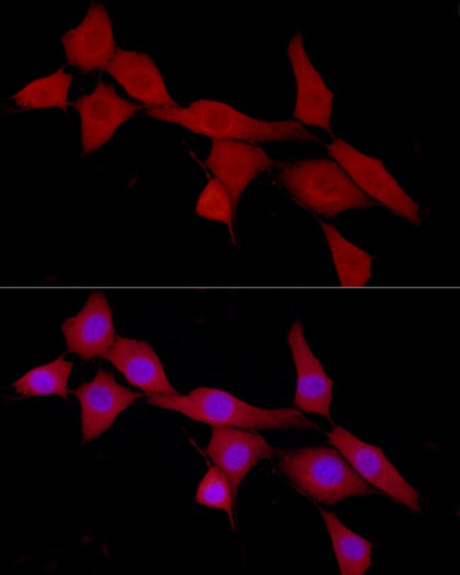 100UL CAB39 ANTIBODY 100 ul