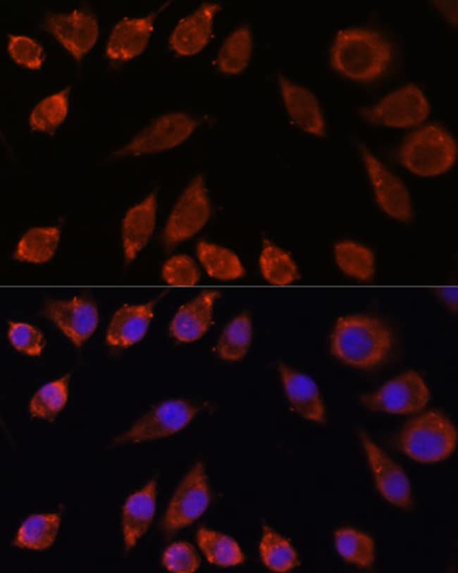 100UL HPS4 ANTIBODY 100 ul