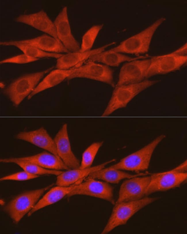 100UL CK2 ALPHA-2 ANTIBODY 100 ul
