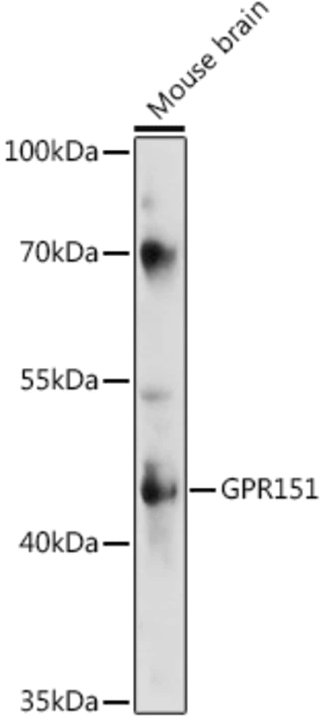 100UL GPR151 ANTIBODY 100 ul