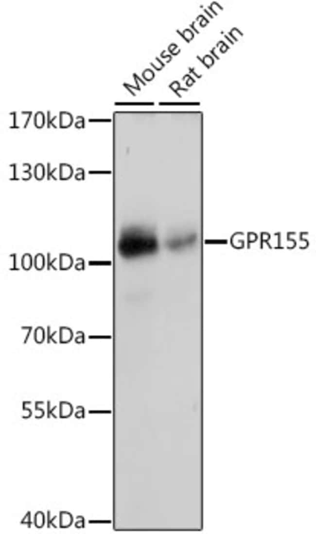 100UL GPR155 ANTIBODY 100 ul