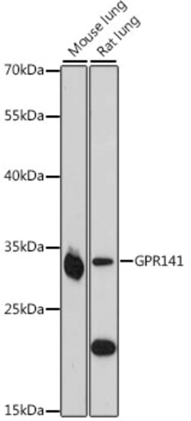 100UL GPR141 ANTIBODY 100 ul