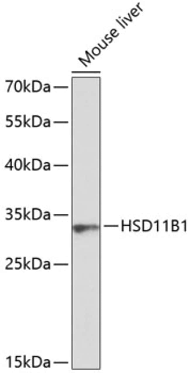 100UL HSD11B1 ANTIBODY 100 ul