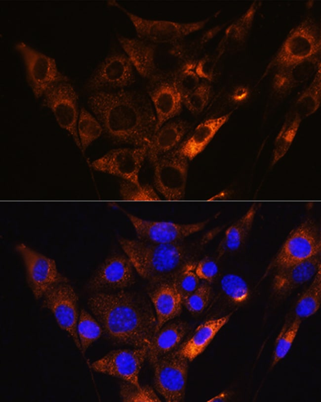 100UL HCN1 ANTIBODY 100 ul