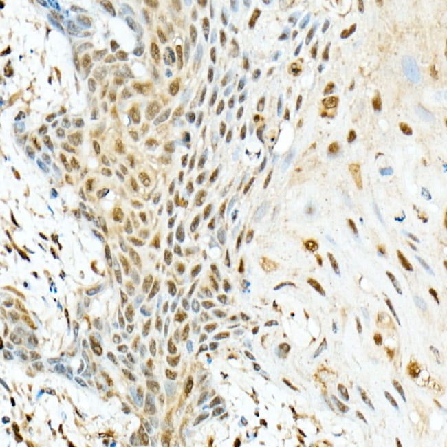 100UL KIAA1429 ANTIBODY 100 ul