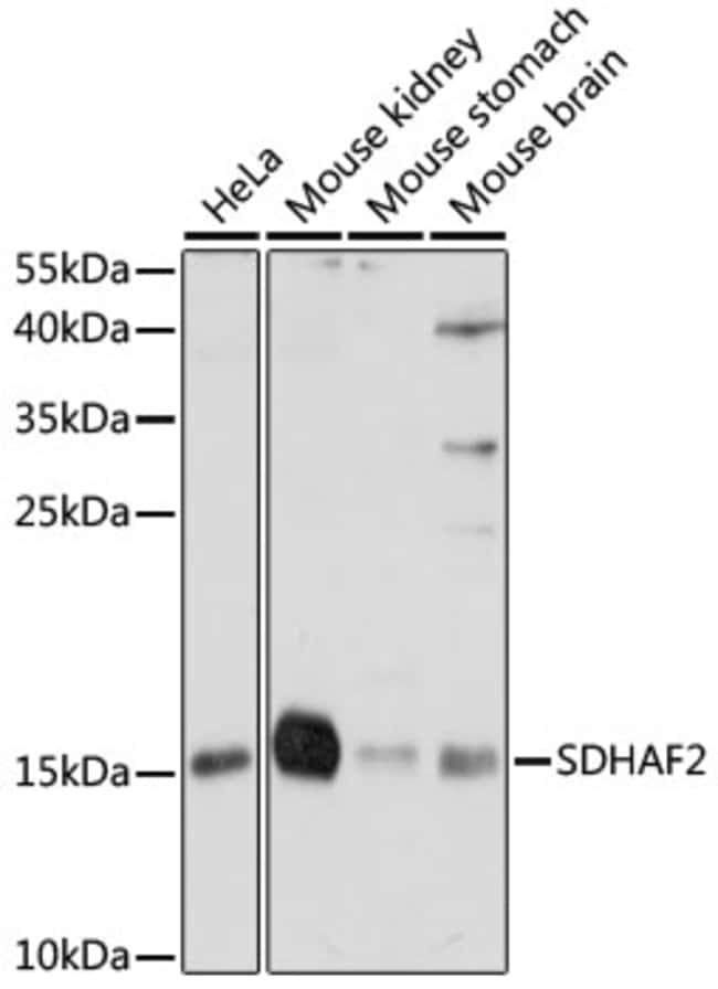 100UL C11ORF79 ANTIBODY 100 ul