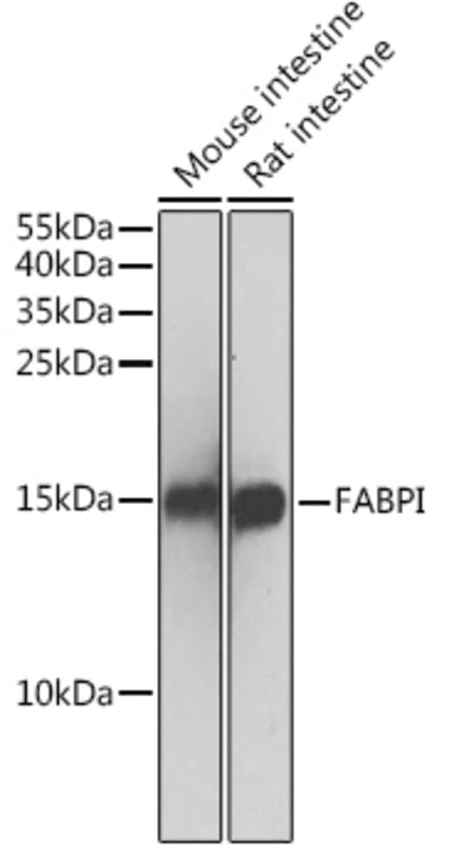 100UL FABP2 ANTIBODY 100 ul