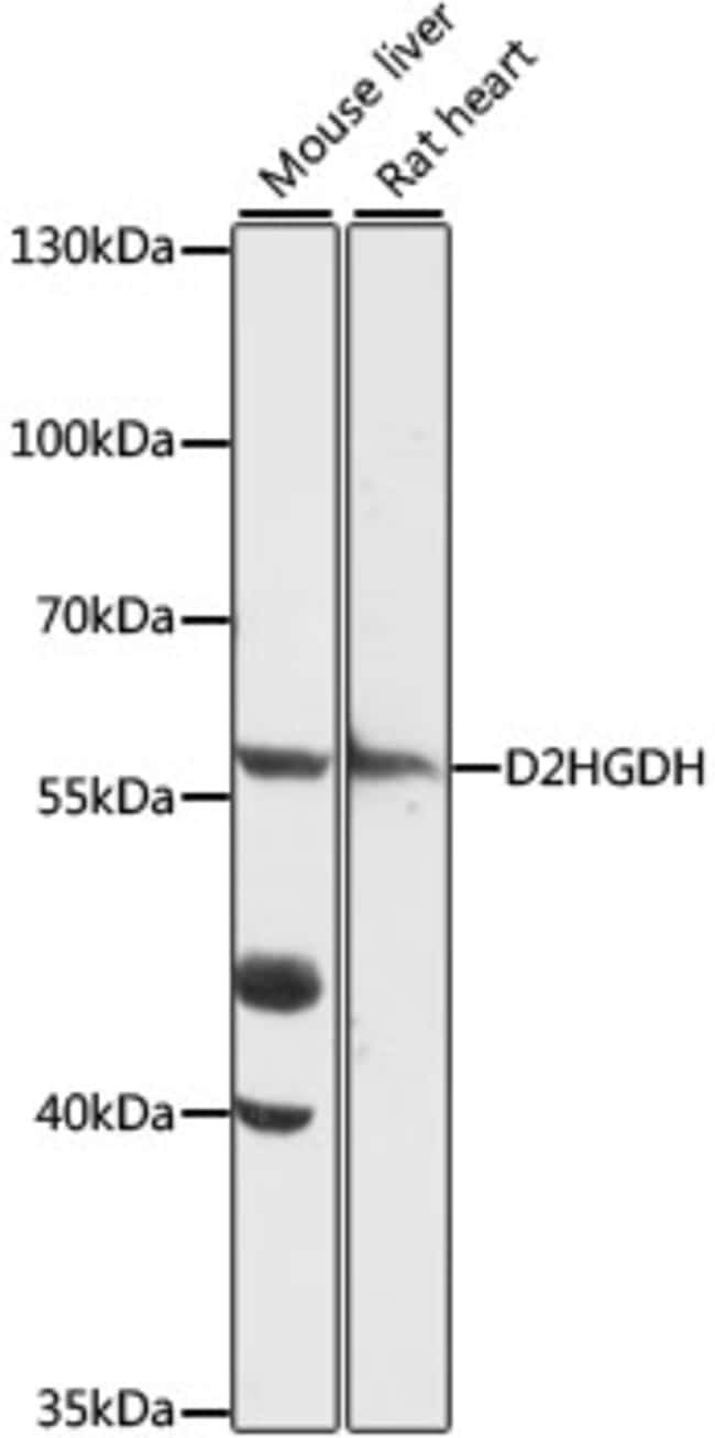 100UL D2HGDH ANTIBODY 100 ul