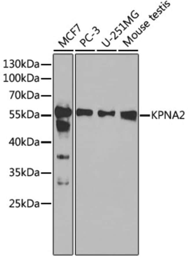 100UL KPNA2 ANTIBODY 100 ul