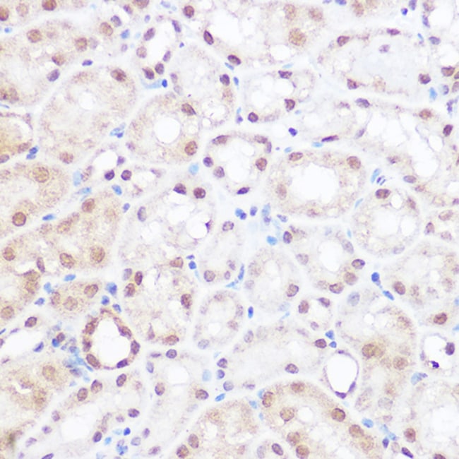 100UL BRD2 ANTIBODY 100 ul