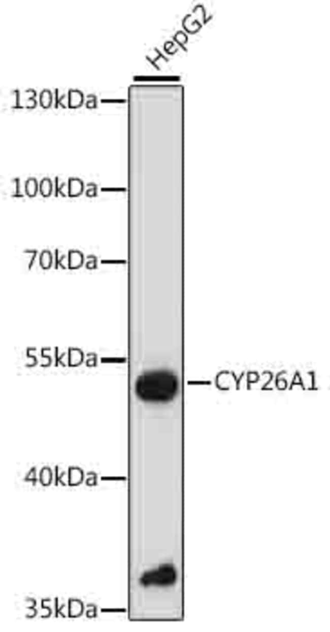 100UL CYP26A1 ANTIBODY 100 ul