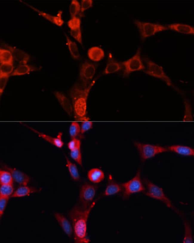 100UL ASM ANTIBODY 100 ul