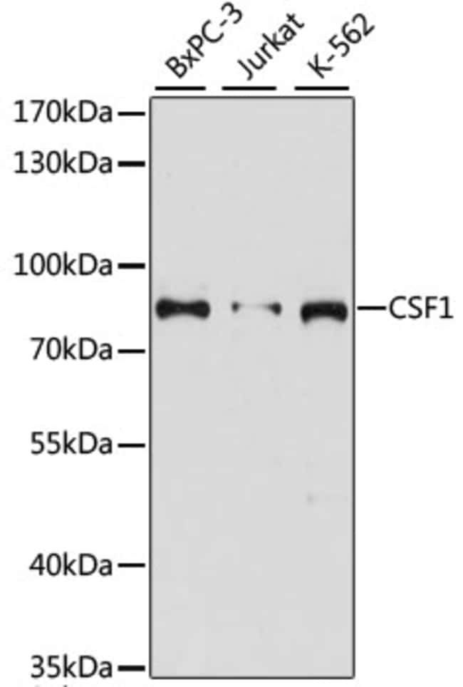 100UL M-CSF ANTIBODY 100 ul