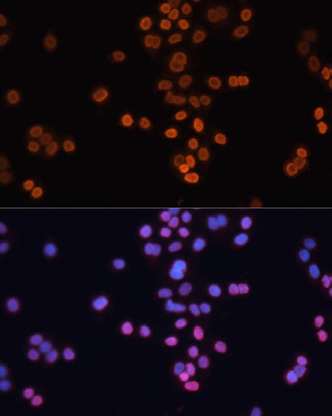 100UL CDX2 ANTIBODY 100 ul
