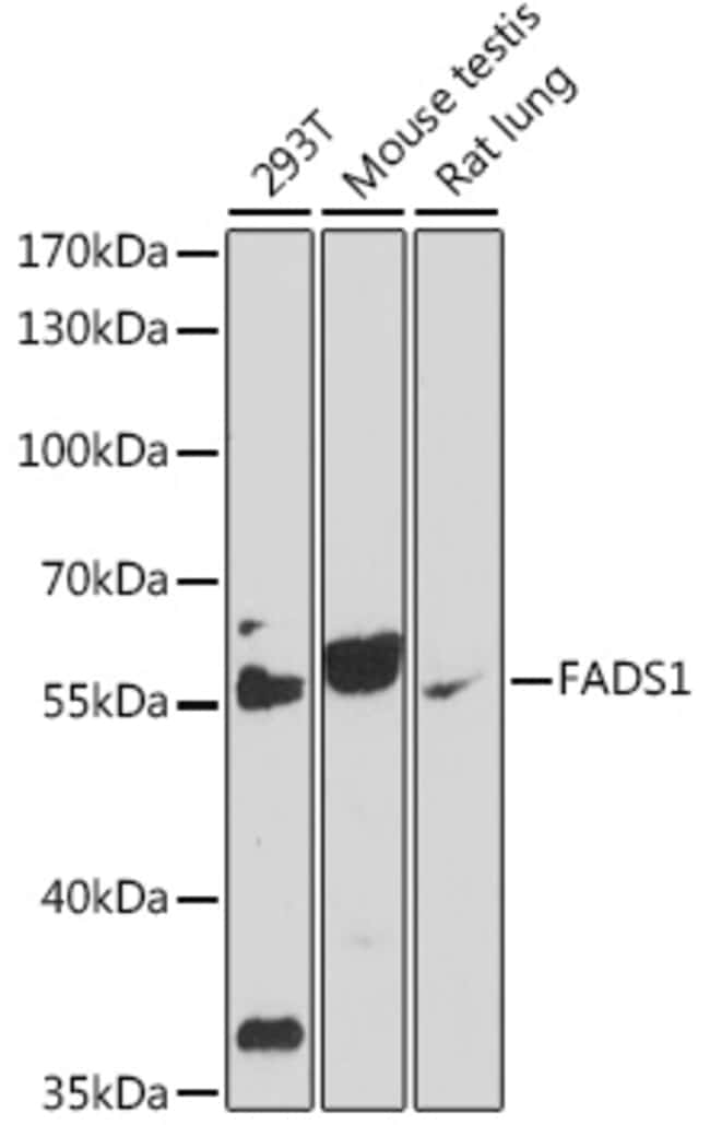 100UL FADS1 ANTIBODY 100 ul