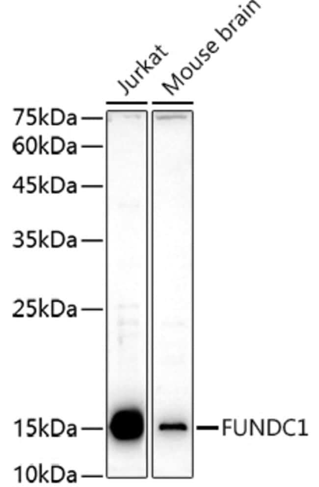 100UL FUNDC1 ANTIBODY 100 ul