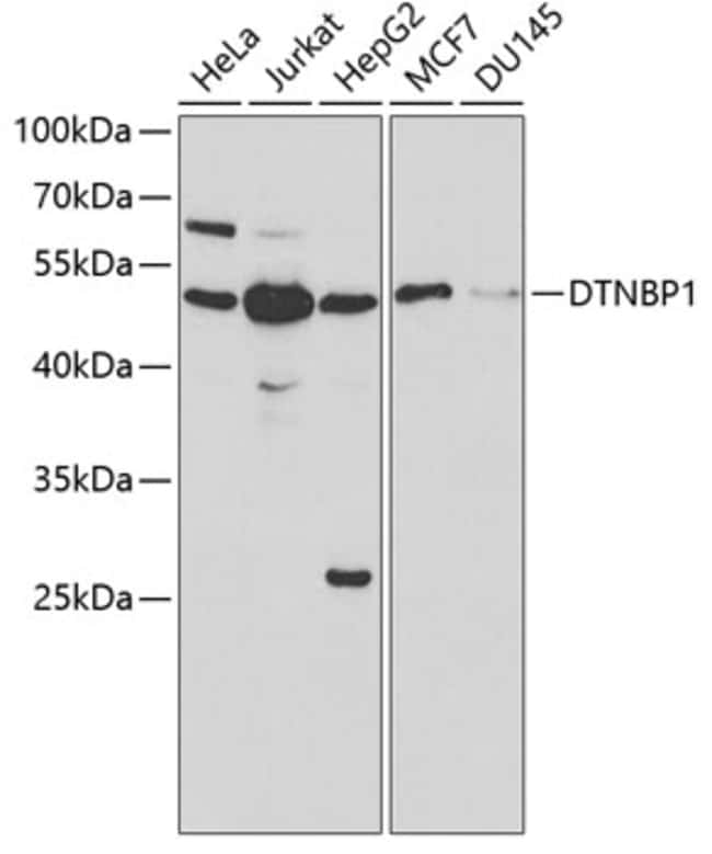 100UL DTNBP1 ANTIBODY 100 ul