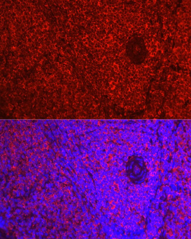 100UL BETA-1 ADRENERGIC RECEPTOR ANT 100