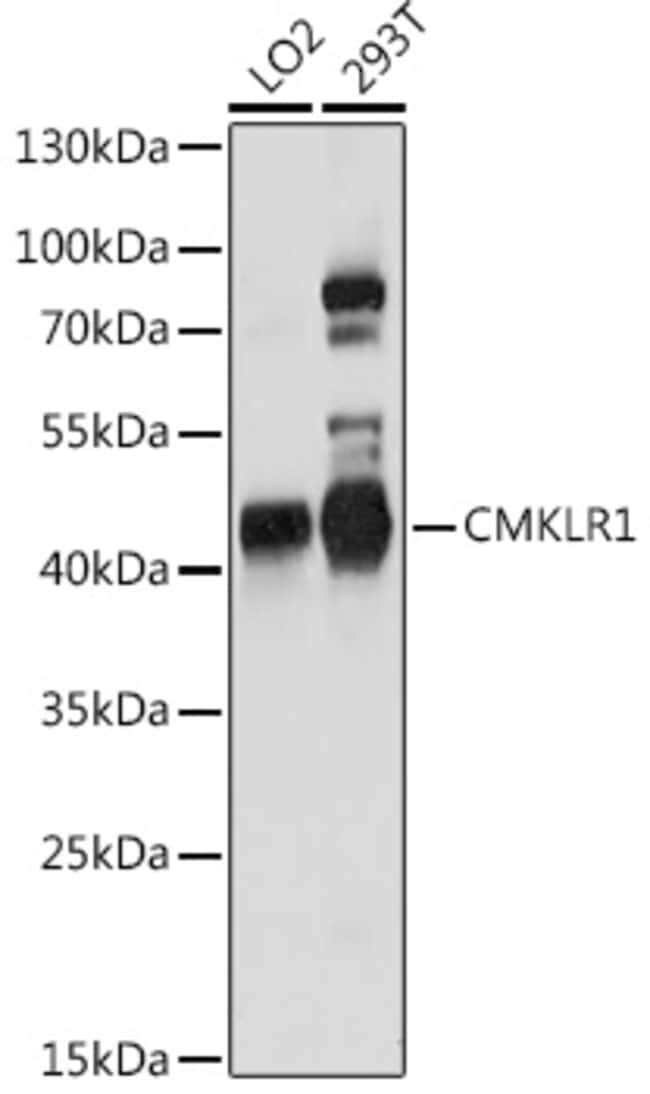 100UL CMKLR1 ANTIBODY 100 ul