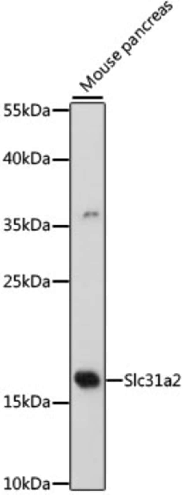 100UL CTR2 ANTIBODY 100 ul