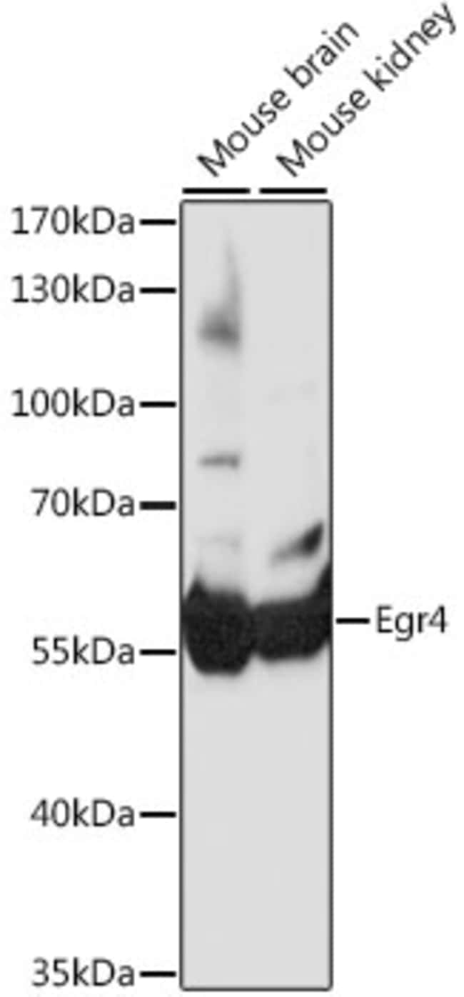 100UL EGR4 ANTIBODY 100 ul