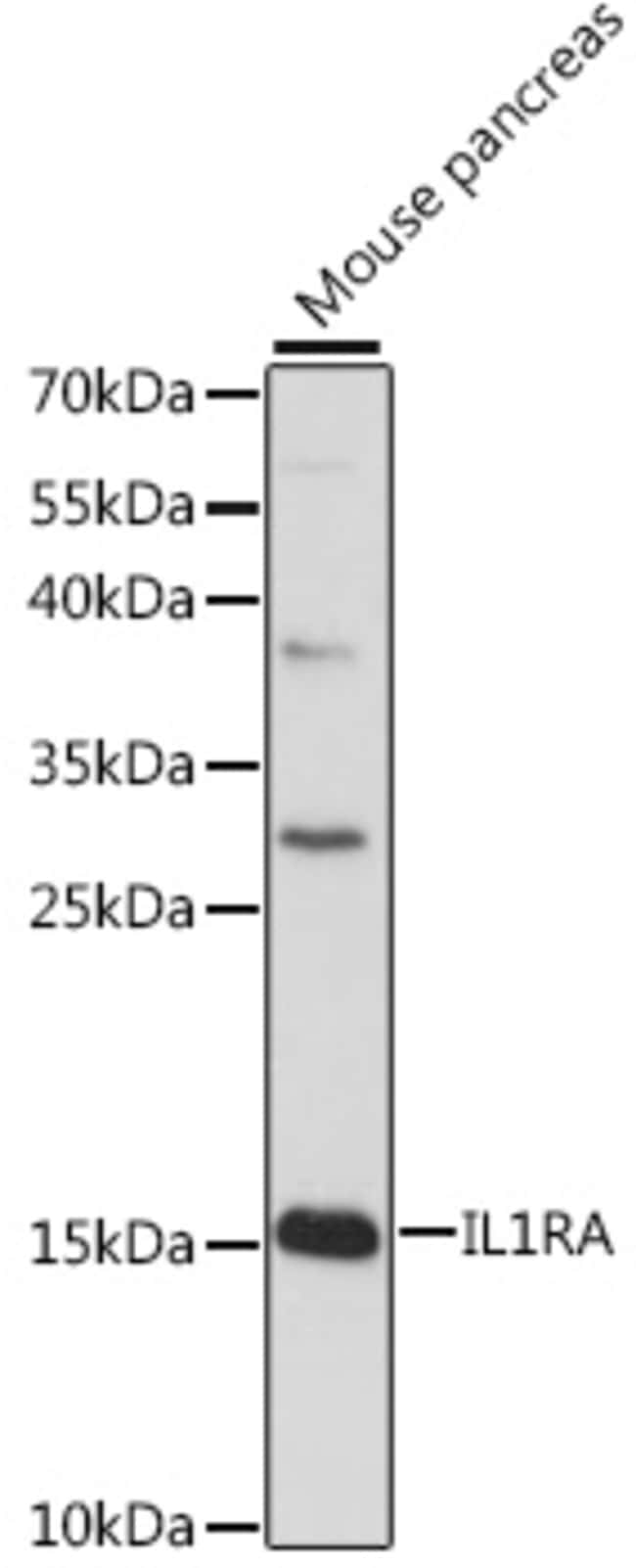 100UL IL1RA ANTIBODY 100 ul