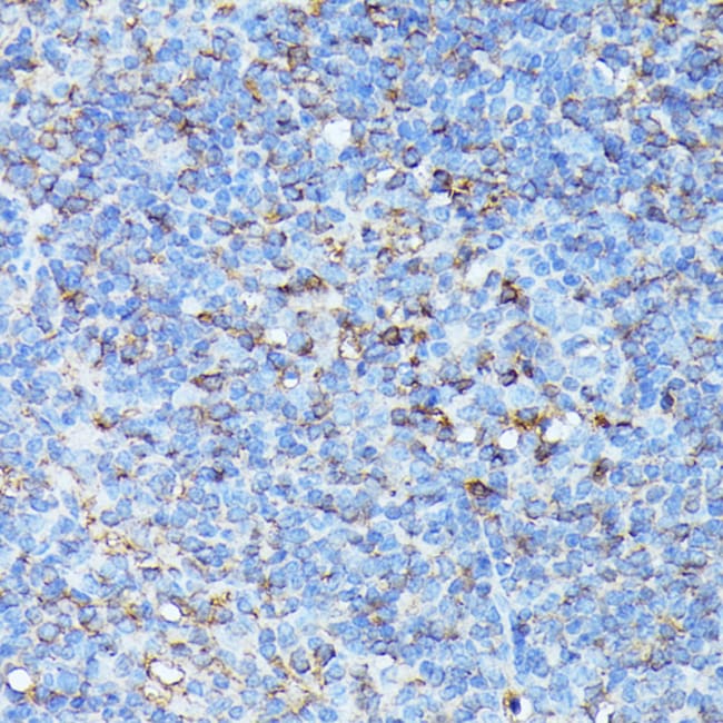 100UL CXCR1 ANTIBODY 100 ul