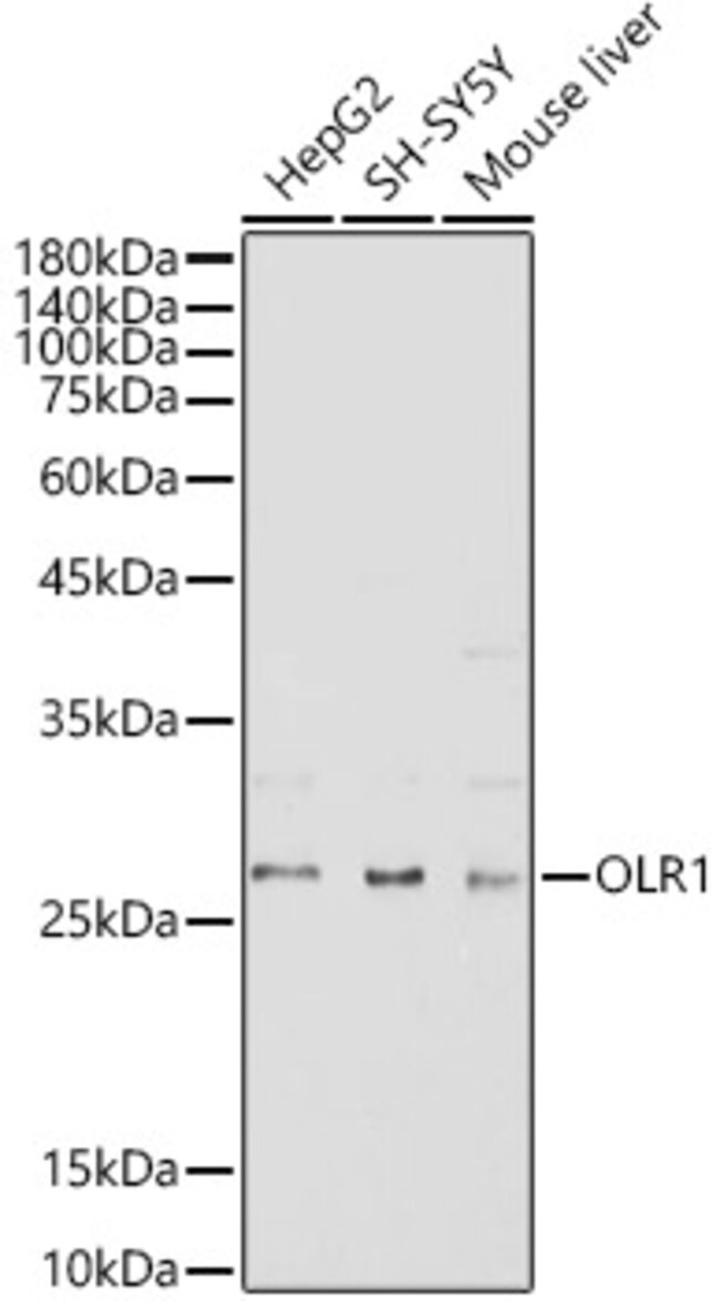 100 UL LOX-1 Polyclonal Antibody (54 µg)