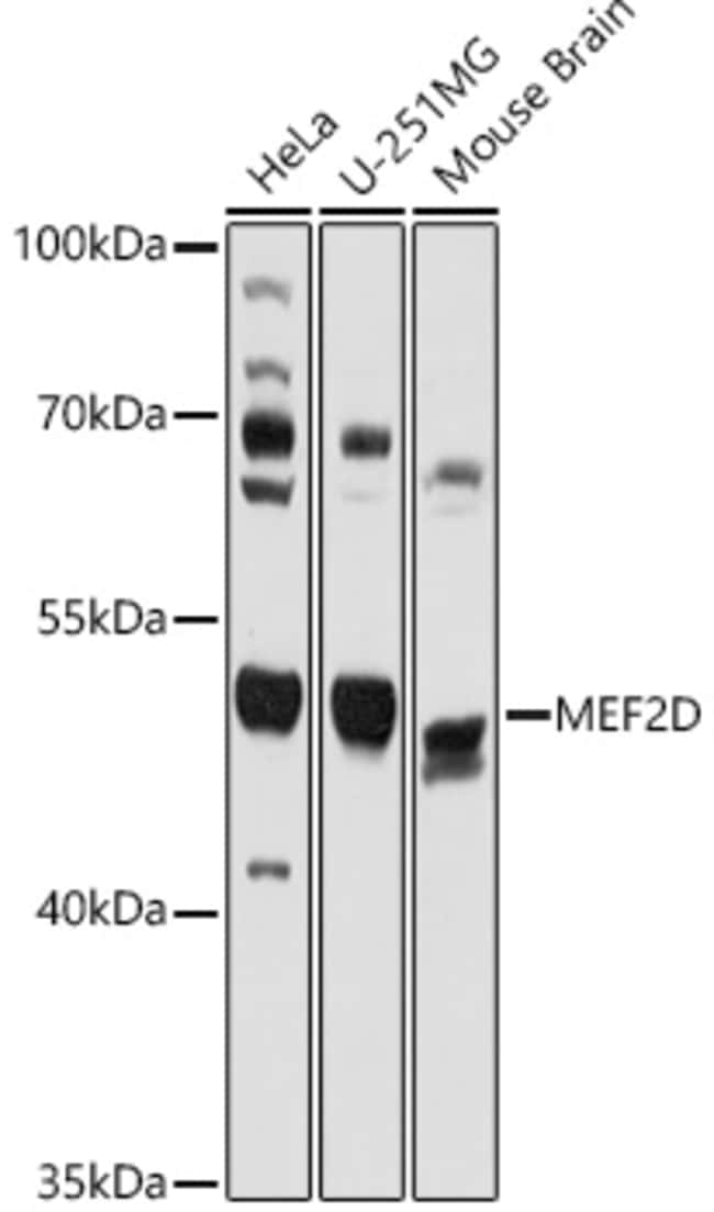 100UL MEF2D ANTIBODY 100 ul