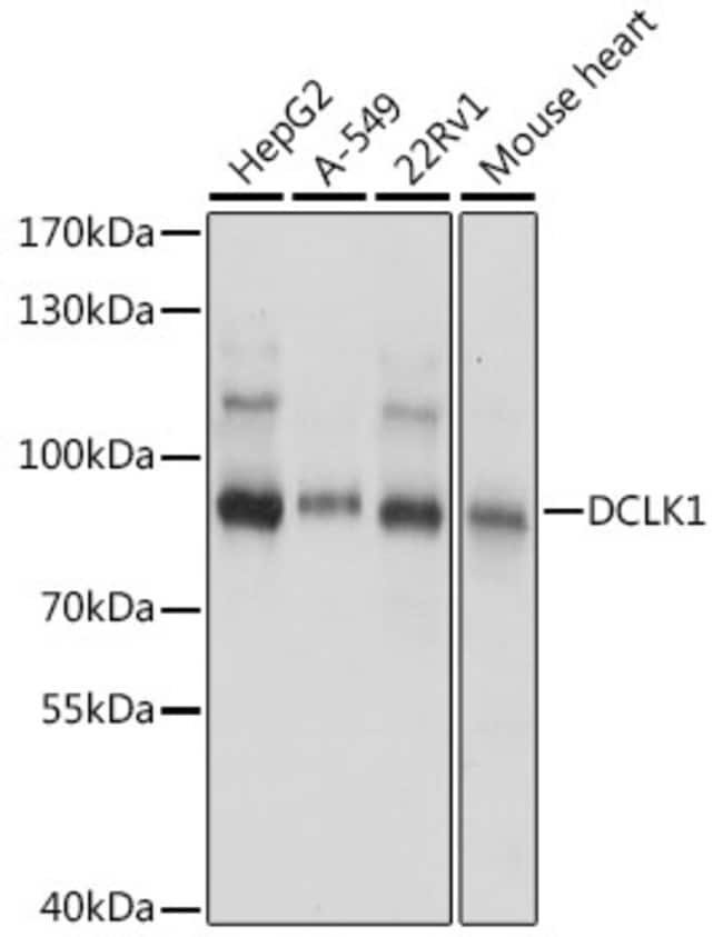 100UL DCLK1 ANTIBODY 100 ul