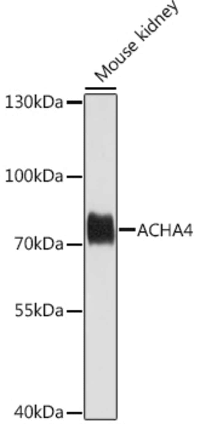 100UL CHRNA4 ANTIBODY 100 ul