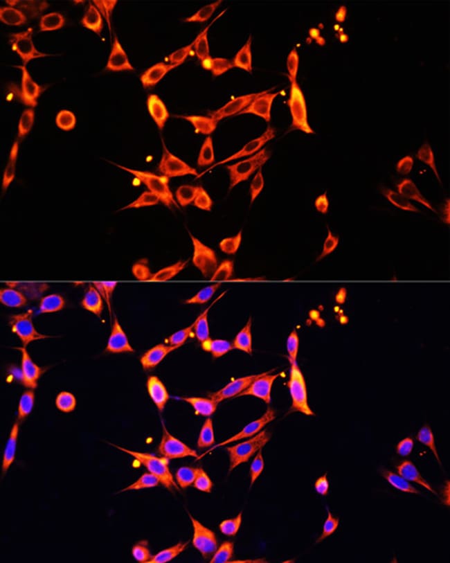 100UL HPA1 ANTIBODY 100 ul