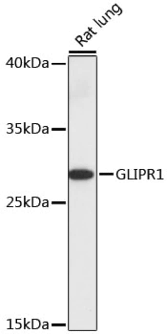 100UL GLIPR1 ANTIBODY 100 ul