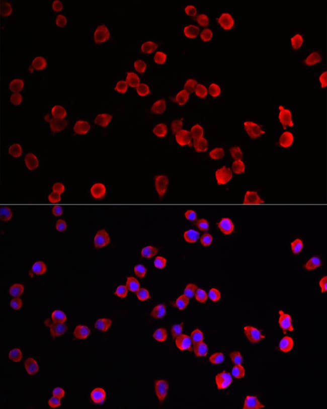 100UL HRH3 ANTIBODY 100 ul