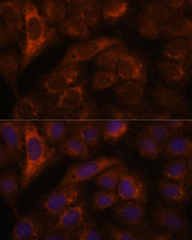 100UL HEBP2 ANTIBODY 100 ul