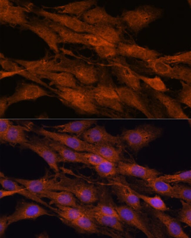 100UL COMMD5 ANTIBODY 100 ul