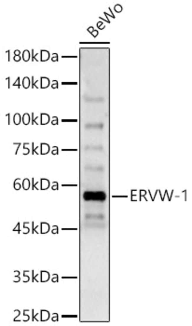 100UL HERV ANTIBODY 100 ul