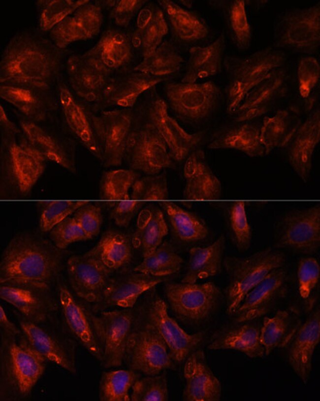 100UL ITSN2 ANTIBODY 100 ul