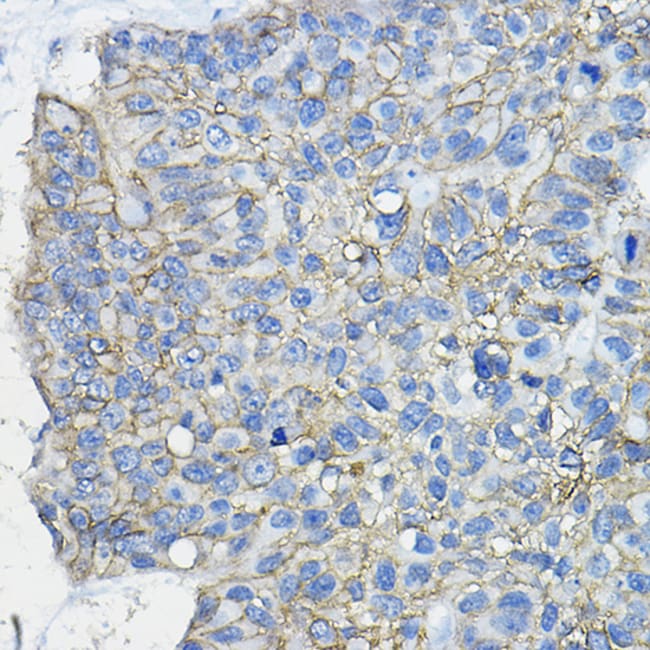 100UL CD46 ANTIBODY 100 ul