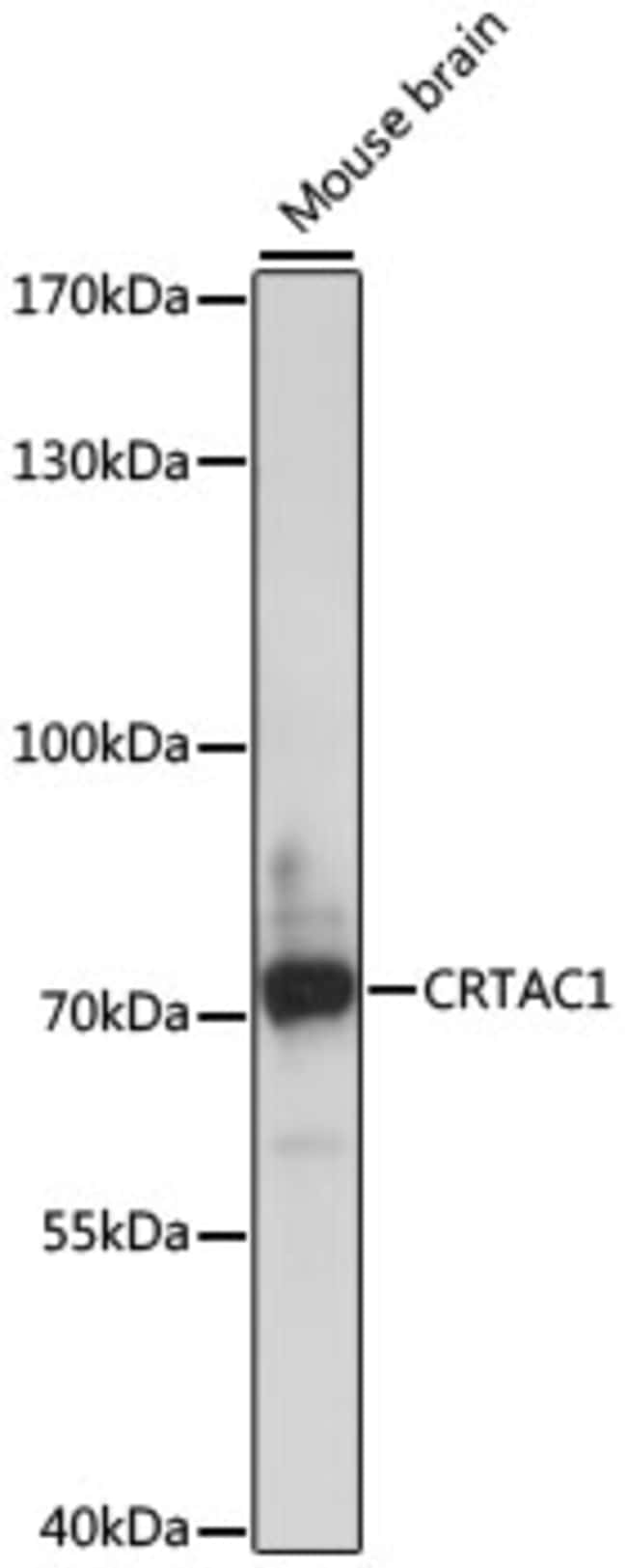 100UL CRTAC1 ANTIBODY 100 ul