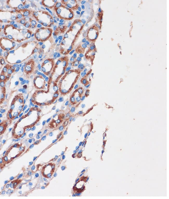 100UL CHDH ANTIBODY 100 ul