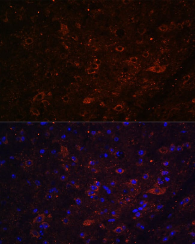 100UL FSTL5 ANTIBODY 100 ul