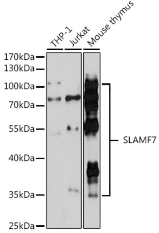 100UL CD319 (CRACC) ANTIBODY 100 ul