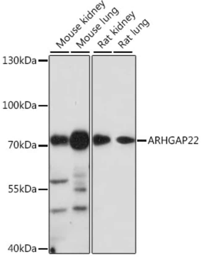 100UL ARHGAP22 ANTIBODY 100 ul