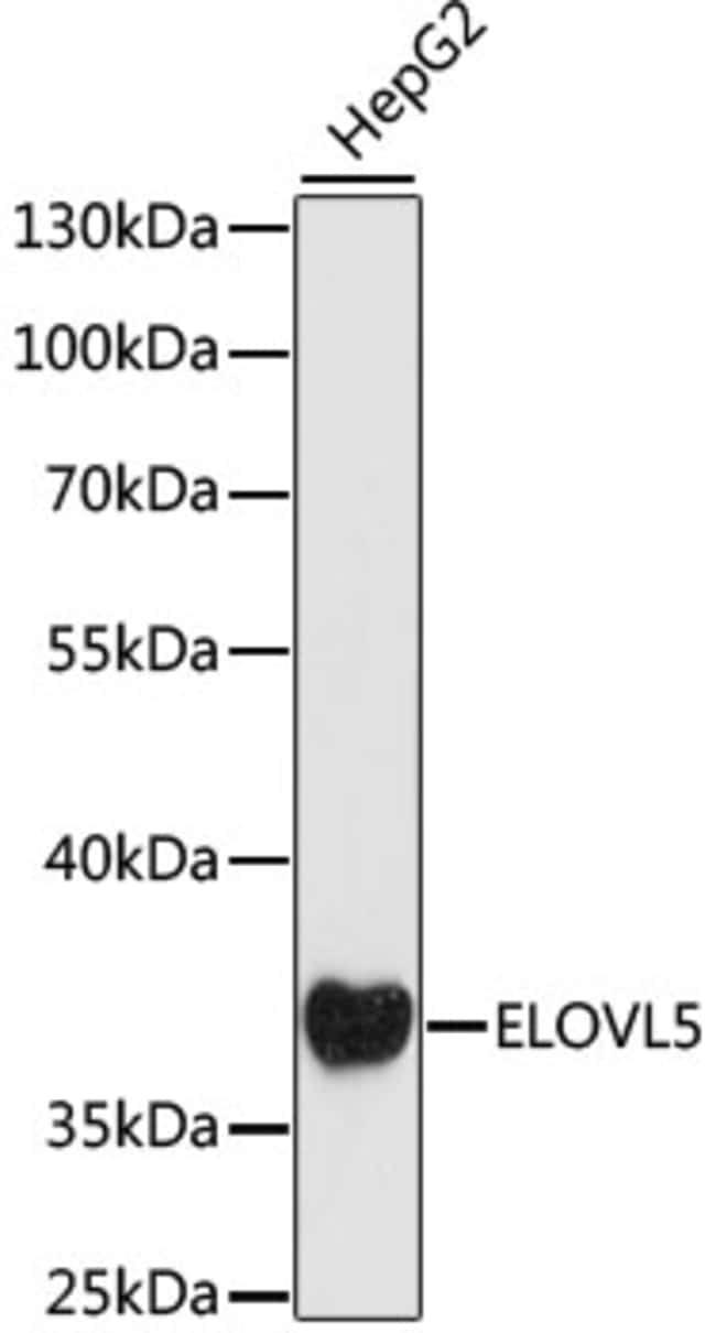 100UL ELOVL5 ANTIBODY 100 ul