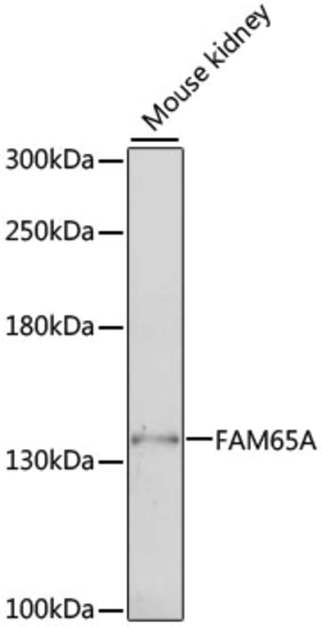 100UL FAM65A ANTIBODY 100 ul
