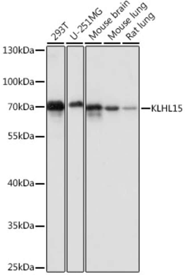 100UL KLHL15 ANTIBODY 100 ul