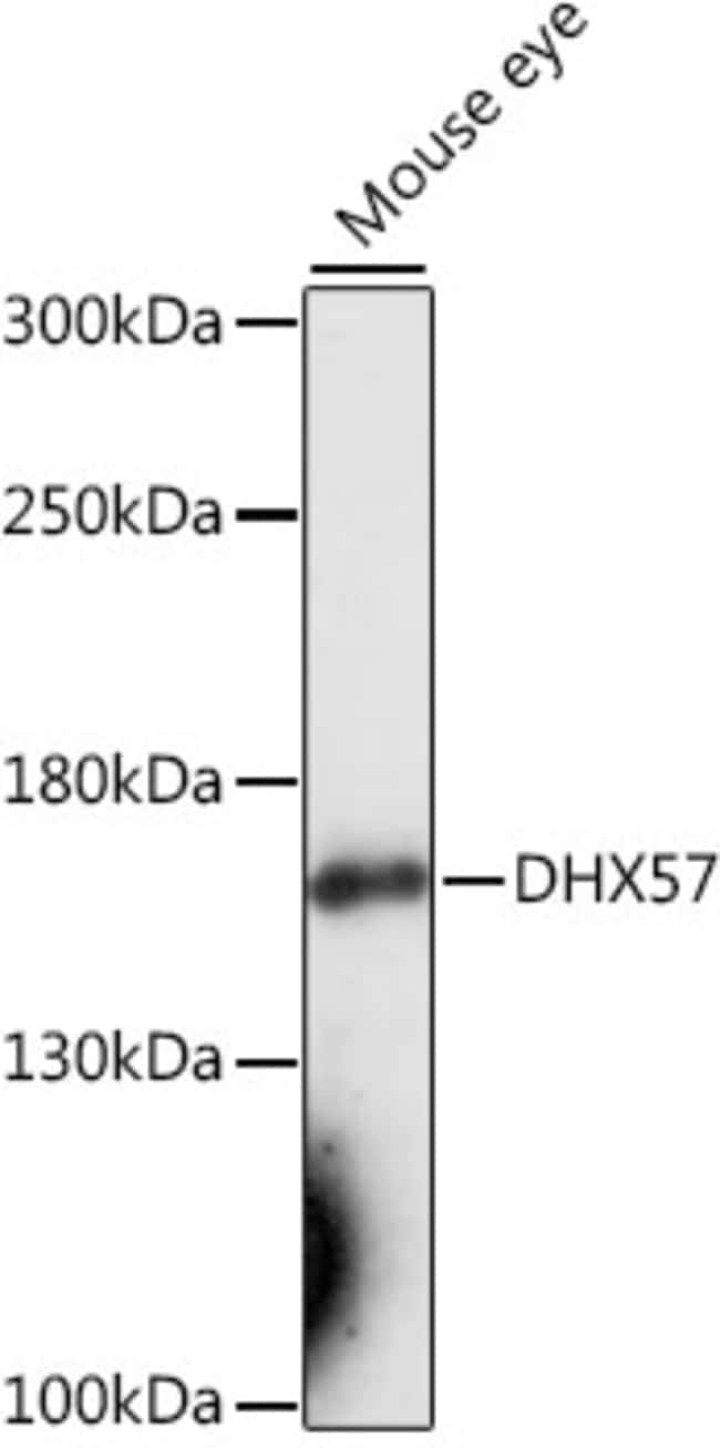 100UL DHX57 ANTIBODY 100 ul